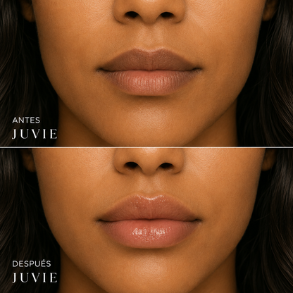 JUVIE™~Voluminizador de Labios con Ácido Hialurónico
